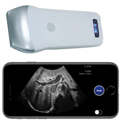 Pocket Ultrasound System PUSG-1000F