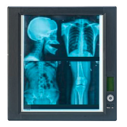 X-ray film view panel XFVP-1000B