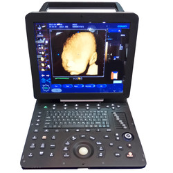 Laptop Ultrasound Scanner LUSG-1000F