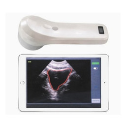 Ultrasound Bladder Scanner UBS-1000B