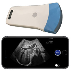 Pocket Ultrasound System PUSG-1000B